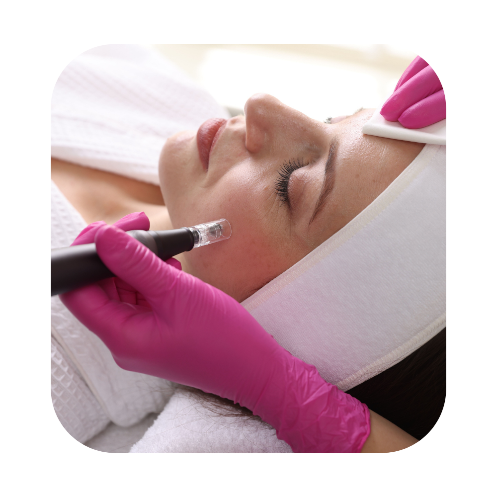 Rejuvenating Microneedling Treatment