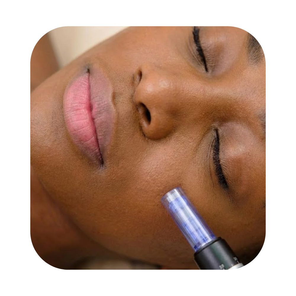 Anti-Aging RF Facial
